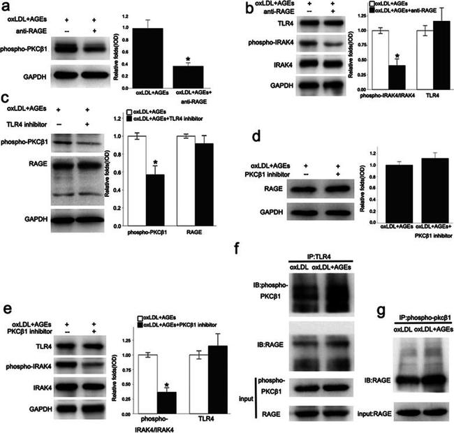 Phospho-PKC beta-1 (Thr642, Thr644) Antibody in Western Blot (WB)