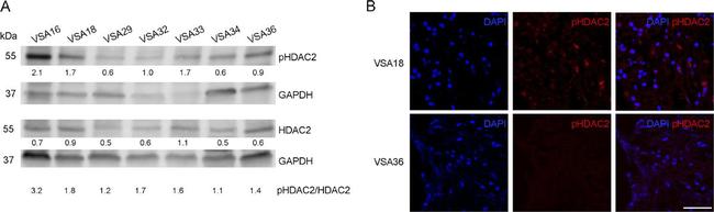 HDAC2 Antibody in Western Blot (WB)