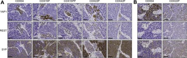 REST Antibody in Immunohistochemistry (IHC)