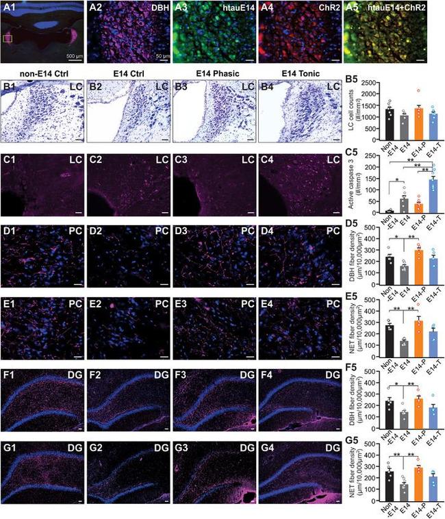 Norepinephrine Transporter Antibody in Immunohistochemistry (IHC)