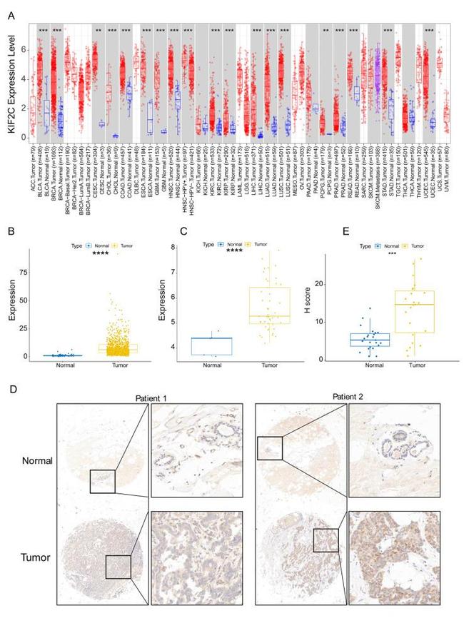 MCAK Antibody in Immunohistochemistry (IHC)