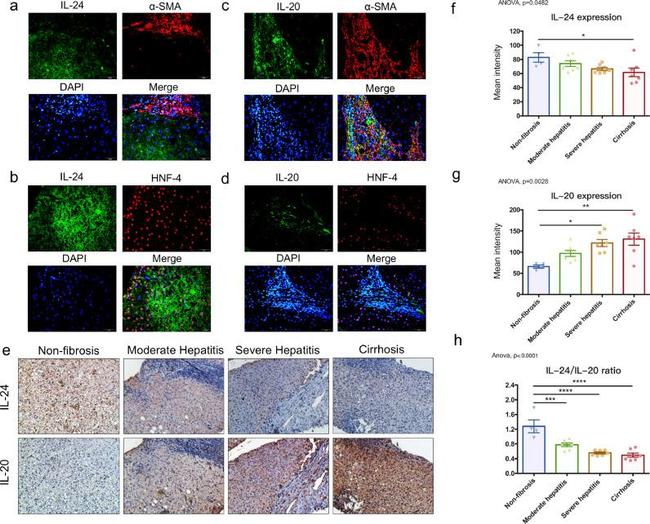 IL24 Antibody in Immunohistochemistry (Paraffin) (IHC (P))