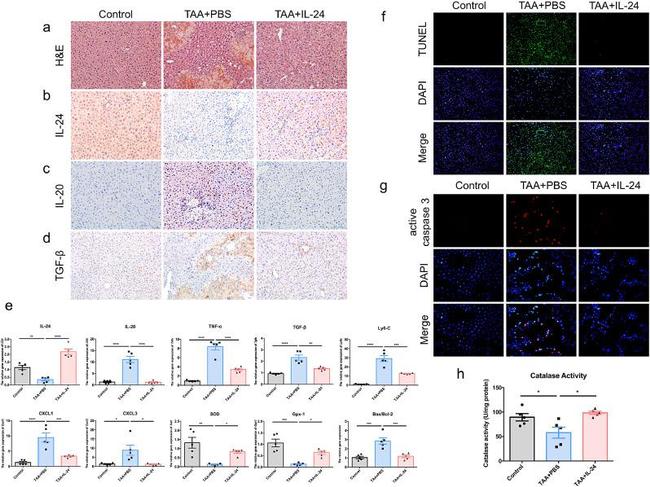 IL24 Antibody in Immunohistochemistry (Paraffin) (IHC (P))