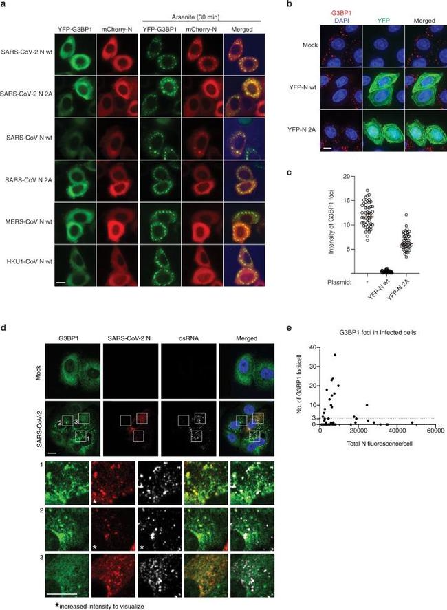 SARS/SARS-CoV-2 Nucleocapsid Antibody in Immunocytochemistry (ICC/IF)