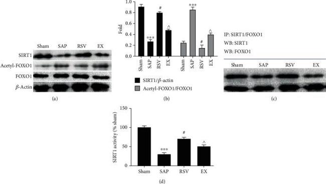 SIRT1 Antibody in Western Blot (WB)