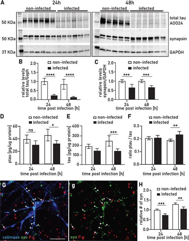 Synapsin 1 Antibody in Western Blot (WB)