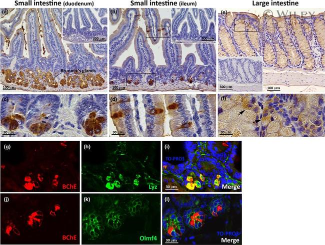 Lysozyme Antibody in Immunohistochemistry (IHC)