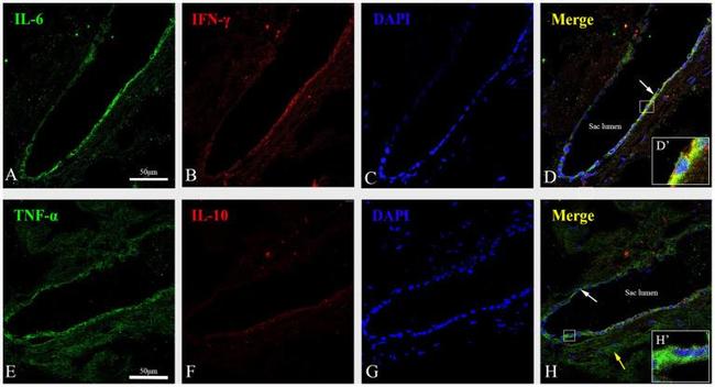 IFN gamma Antibody in Immunohistochemistry (Paraffin) (IHC (P))