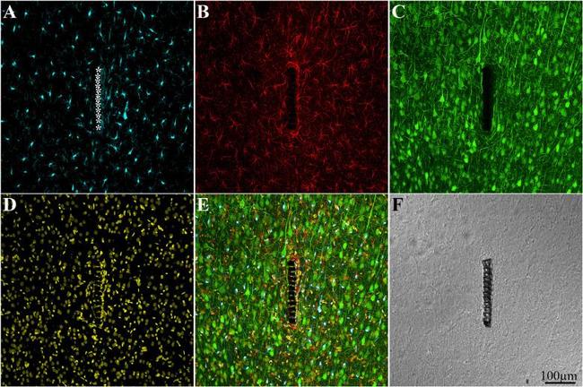 GFAP Antibody in Immunohistochemistry (IHC)