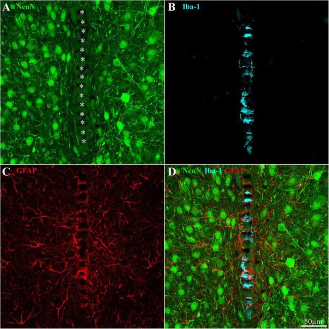 GFAP Antibody in Immunohistochemistry (IHC)