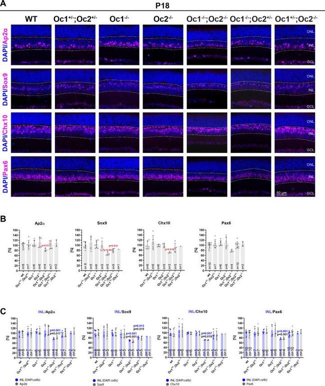 CHX10 Antibody in Immunohistochemistry (IHC)