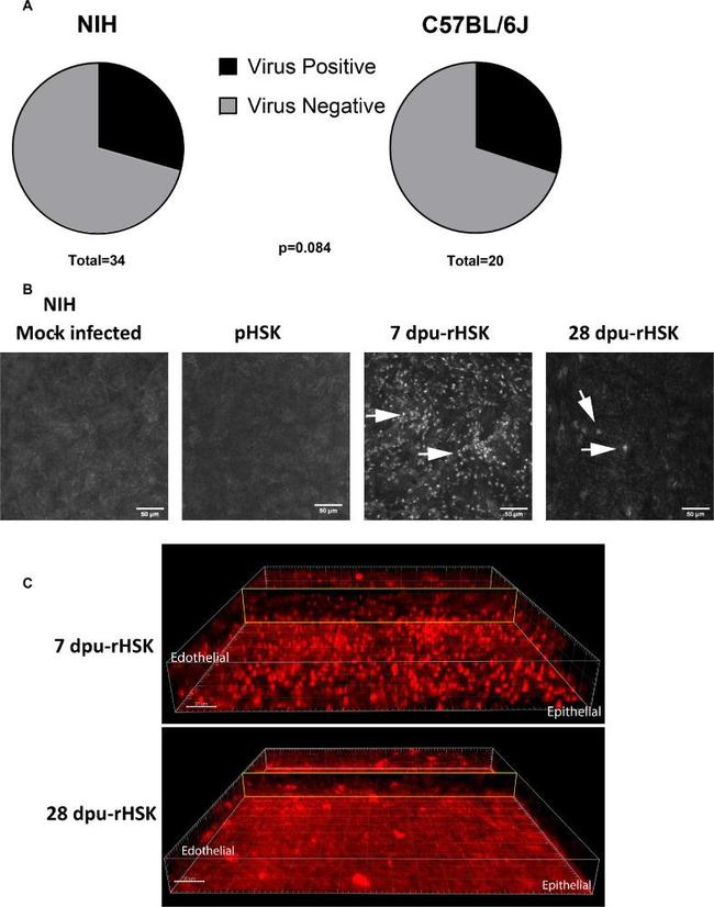 HSV Type 1 Antibody in Immunohistochemistry (PFA fixed) (IHC (PFA))