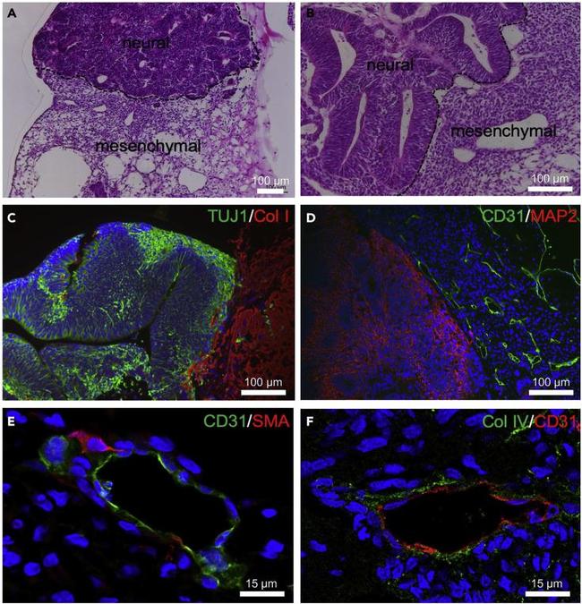 Collagen I Antibody in Immunohistochemistry (IHC)