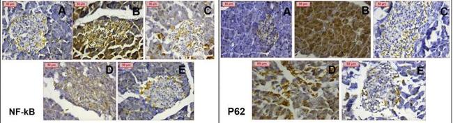 NFkB p65 Antibody in Immunohistochemistry (Paraffin) (IHC (P))