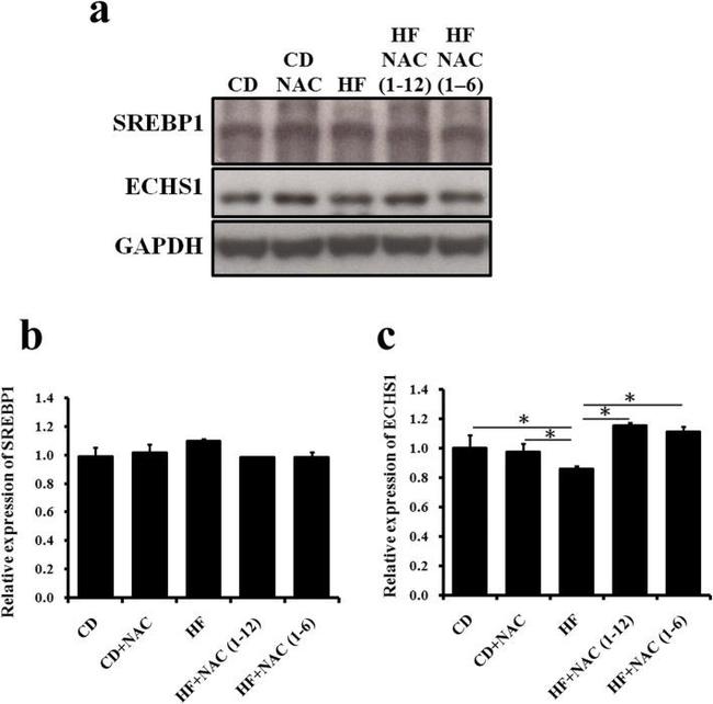 SREBP1 Antibody in Western Blot (WB)