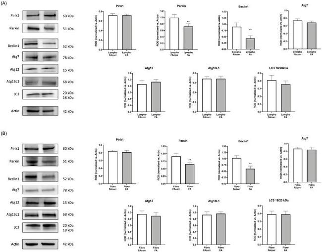 Parkin Antibody in Western Blot (WB)