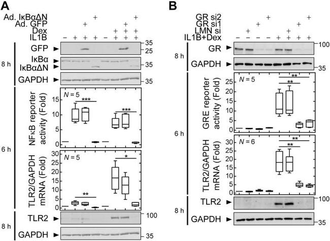 Glucocorticoid Receptor Antibody in Western Blot (WB)