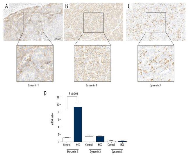 Dynamin 3 Antibody in Immunohistochemistry (IHC)