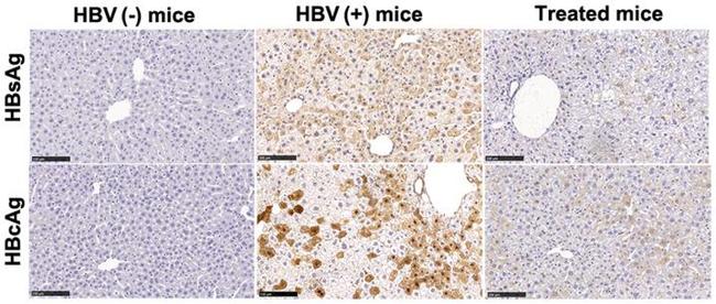 Hepatitis B Virus Surface Ad/Ay Antibody in Immunohistochemistry (IHC)