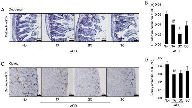 Calbindin D28K Antibody in Immunohistochemistry (Paraffin) (IHC (P))