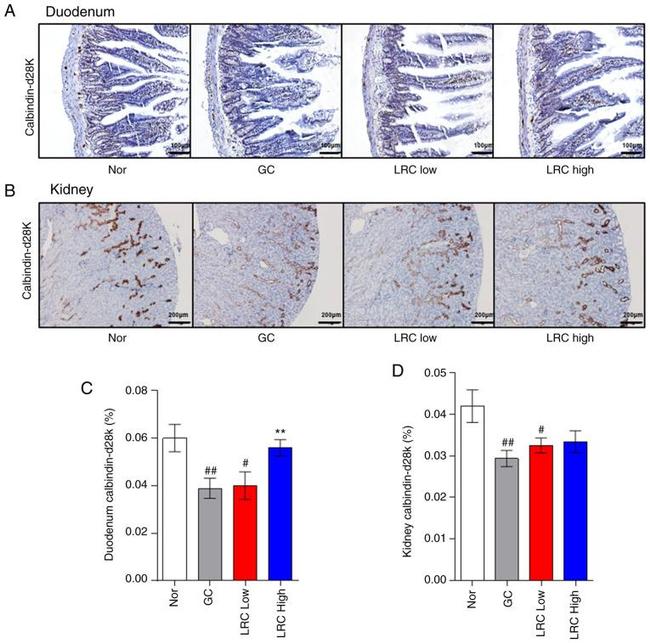 Calbindin D28K Antibody in Immunohistochemistry (Paraffin) (IHC (P))