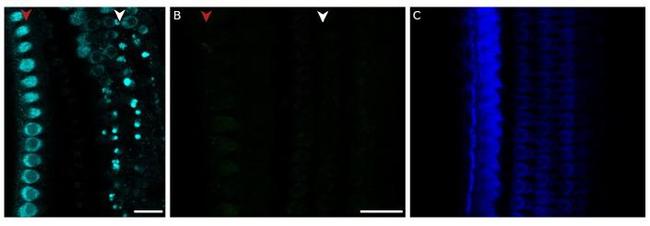 MYO7A Antibody in Immunohistochemistry (PFA fixed) (IHC (PFA))