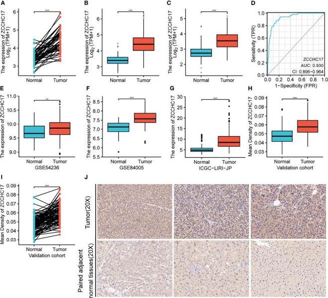 ZCCHC17 Antibody in Immunohistochemistry (IHC)