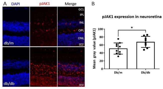 Phospho-JAK1 (Tyr1034) Antibody in Immunohistochemistry (Paraffin) (IHC (P))