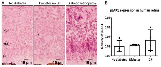 Phospho-JAK1 (Tyr1034) Antibody in Immunohistochemistry (Paraffin) (IHC (P))