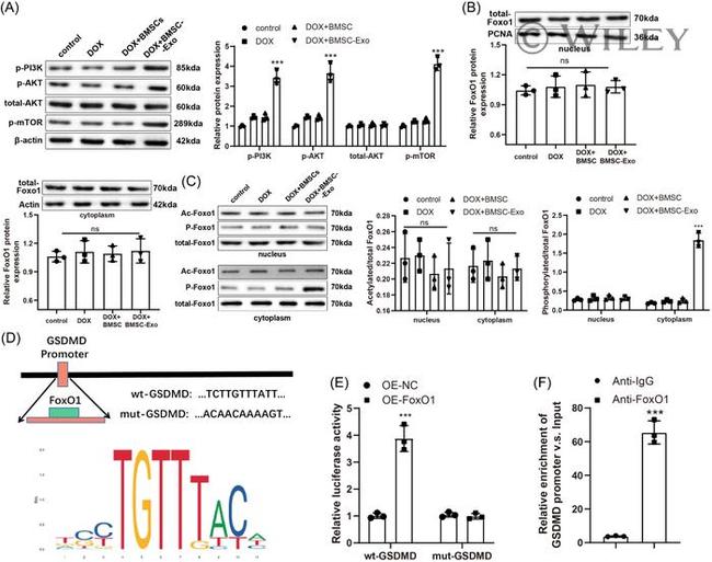 Acetyl-FOXO1 (Lys294) Antibody in Western Blot (WB)