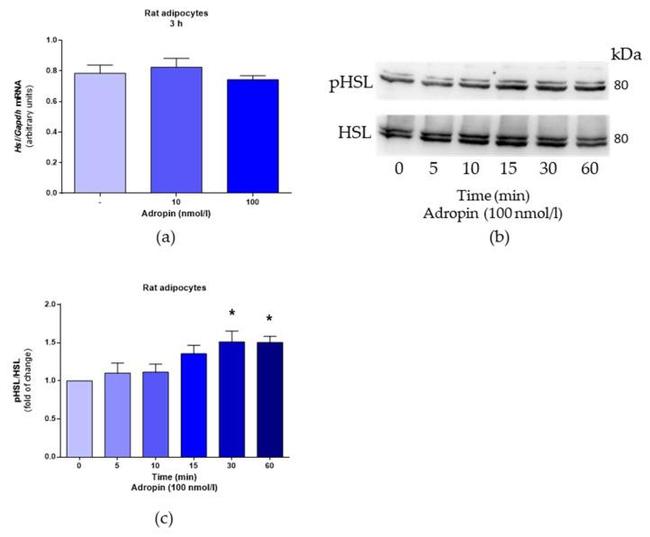 HSL Antibody in Western Blot (WB)