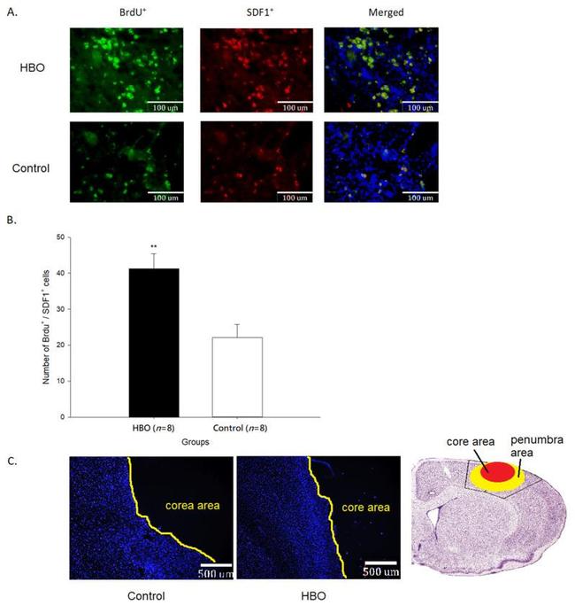 SDF1 Antibody in Immunohistochemistry (IHC)