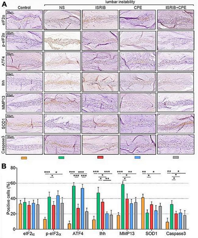 Caspase 3 (Cleaved Asp175) Antibody in Immunohistochemistry (IHC)