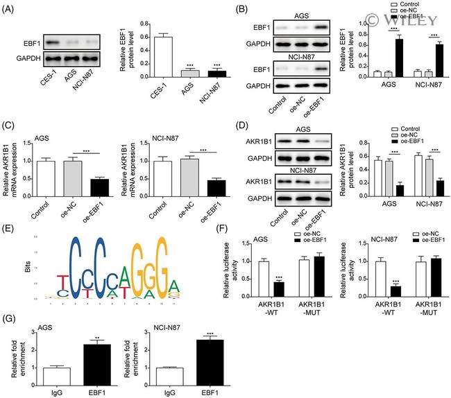 AKR1B1 Antibody in Western Blot (WB)