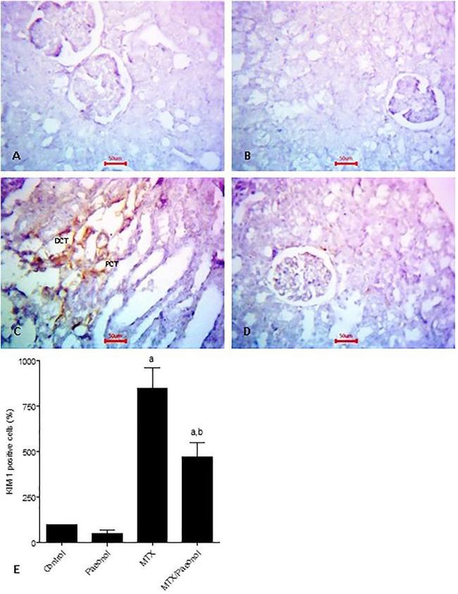 KIM-1 Antibody in Immunohistochemistry (IHC)