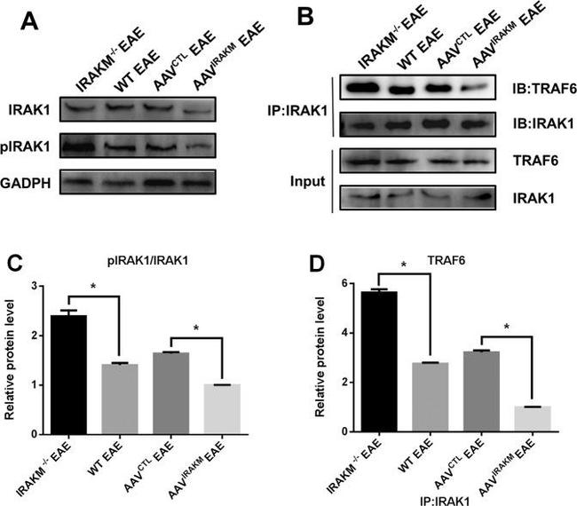 IRAK1 Antibody in Western Blot, Immunoprecipitation (WB, IP)