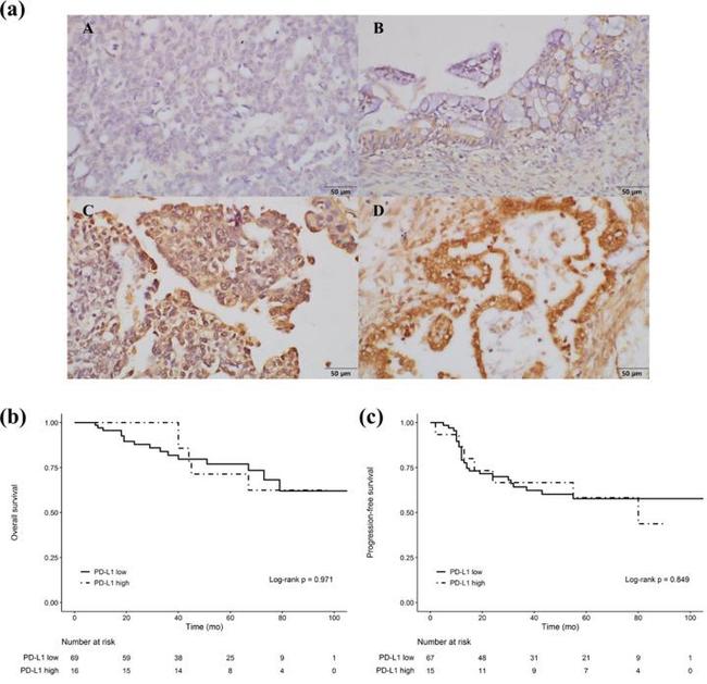 PD-L1 Antibody in Immunohistochemistry (IHC)