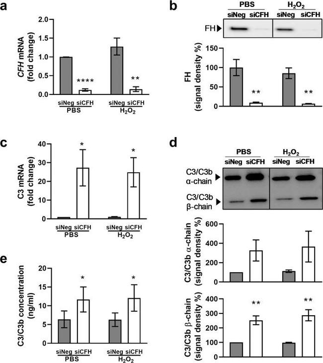 Complement C3 Antibody in Western Blot (WB)