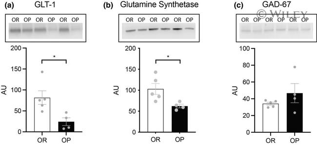 GAD67 Antibody in Western Blot (WB)