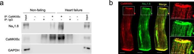 CaMKII delta Antibody in Immunoprecipitation (IP)