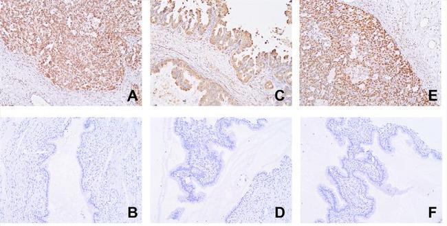 FOXC2 Antibody in Immunohistochemistry (Paraffin) (IHC (P))