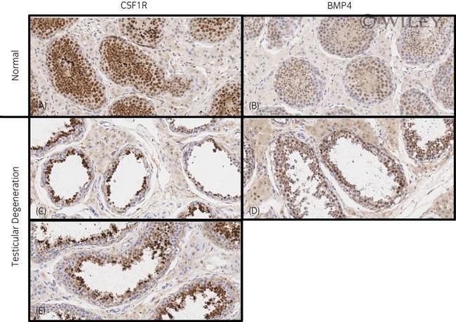 CSF1R Antibody in Immunohistochemistry (IHC)