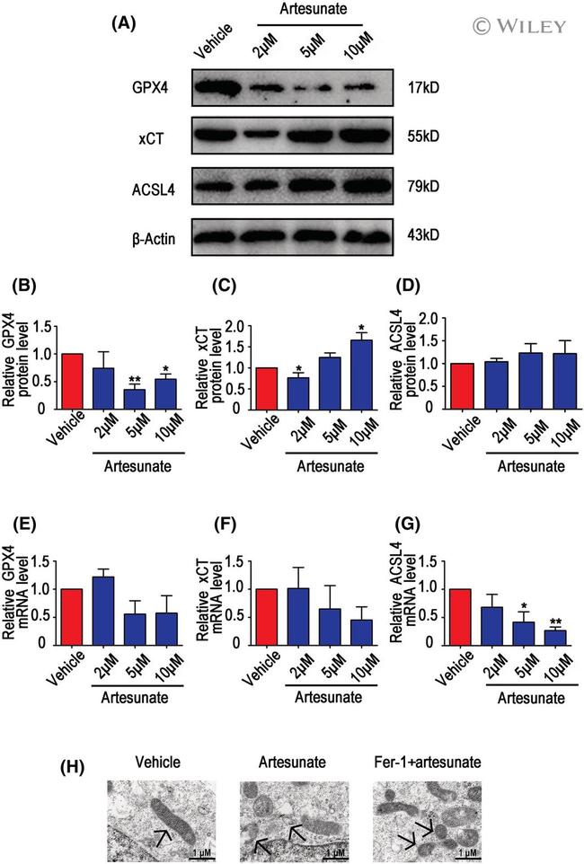 ACSL4 Antibody in Western Blot (WB)