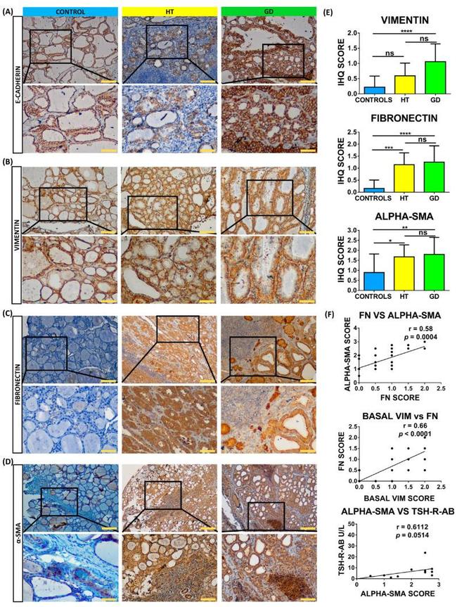 Vimentin Antibody in Immunohistochemistry (IHC)