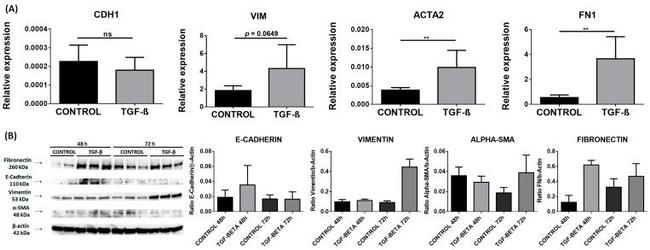 Vimentin Antibody in Western Blot (WB)