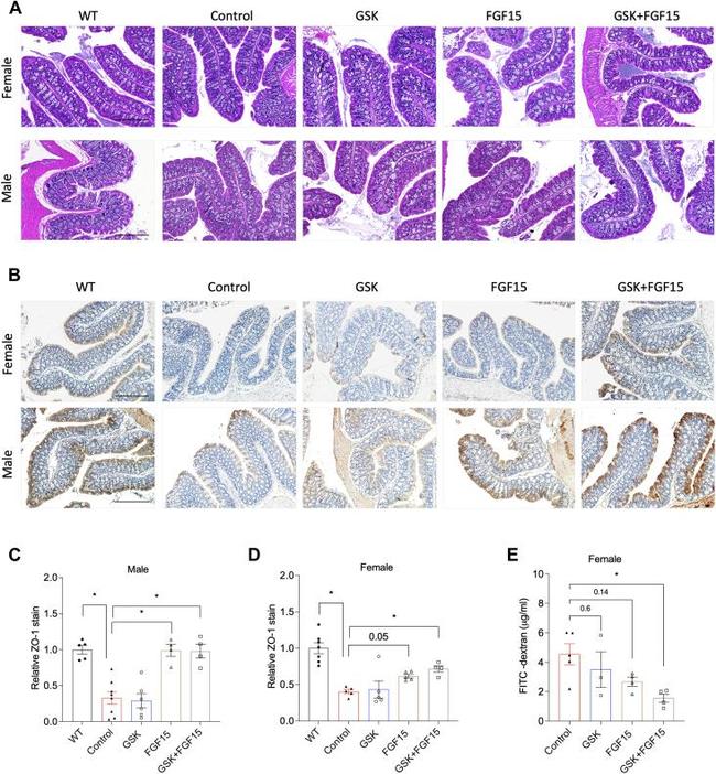 ZO-1 Antibody in Immunohistochemistry (IHC)