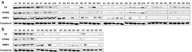 Complement C9 Antibody in Western Blot (WB)