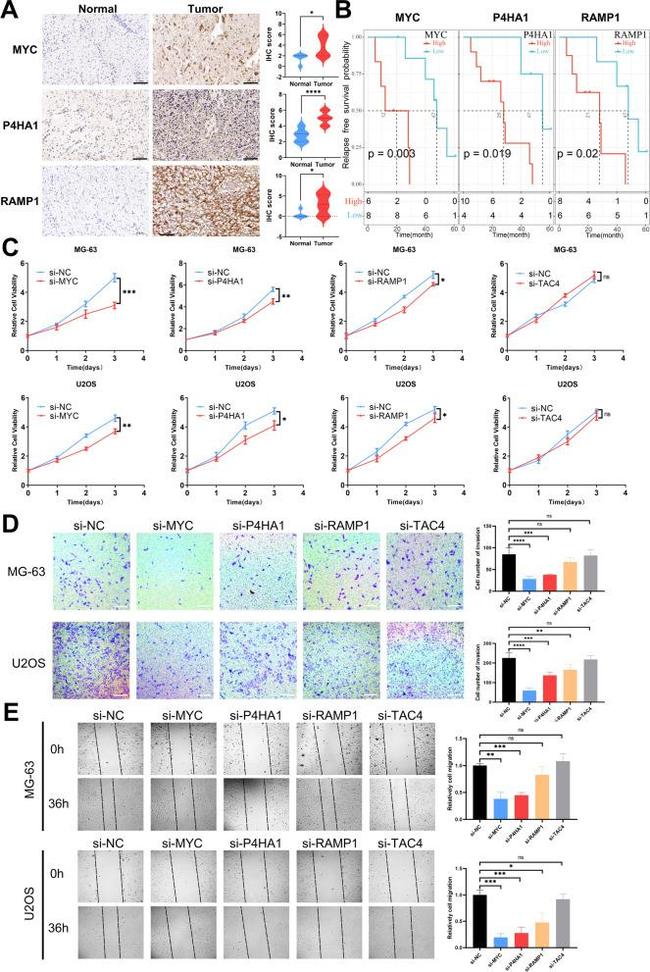 P4HA1 Antibody in Immunohistochemistry (IHC)