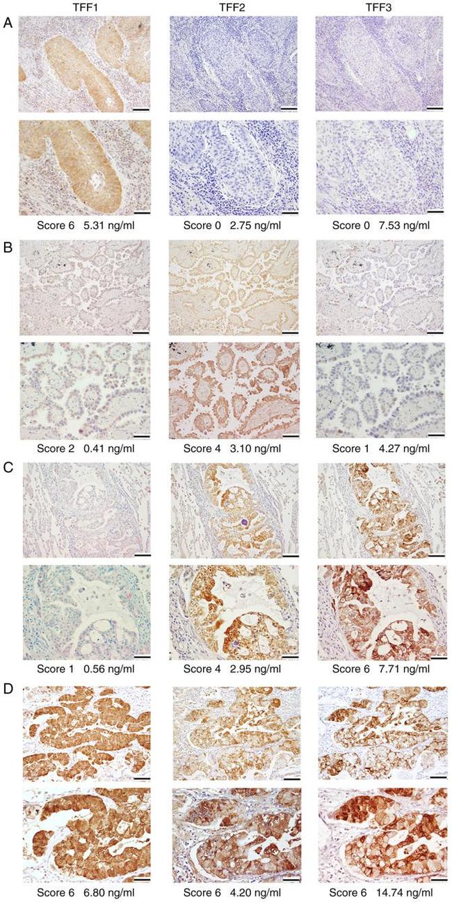 TFF1 Antibody in Immunohistochemistry (IHC)