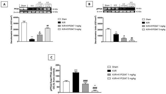 Phospho-PP2A alpha (Tyr307) Antibody in Western Blot (WB)